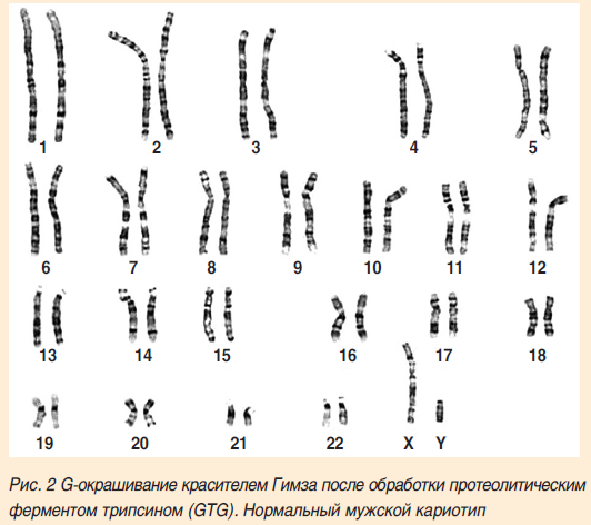 Рисунок2(1).png