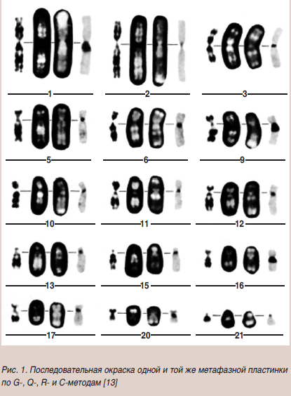 Рисунок1(1).png