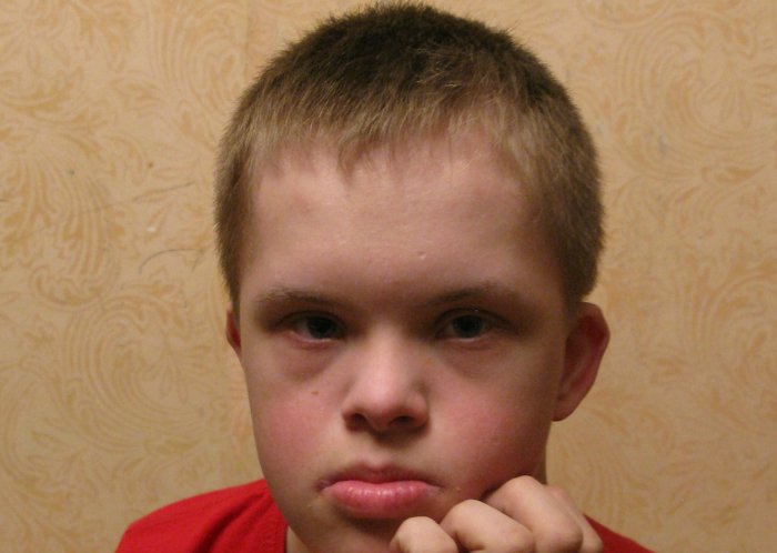 Стишки детям с синдромом дауна