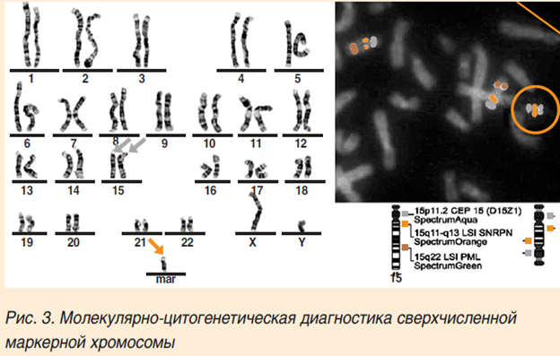 Рисунок3(1).png