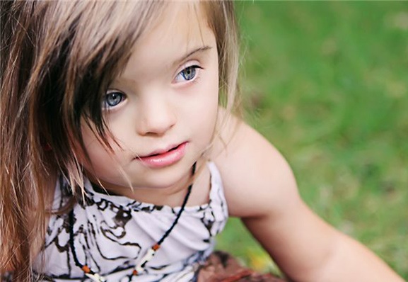 Синдром Дауна: Реабилитация - лечение и развитие детей с синдромом Дауна.