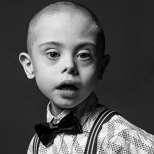 «Синдром любви» - фотовыставка посвященная детям с синдромом Дауна