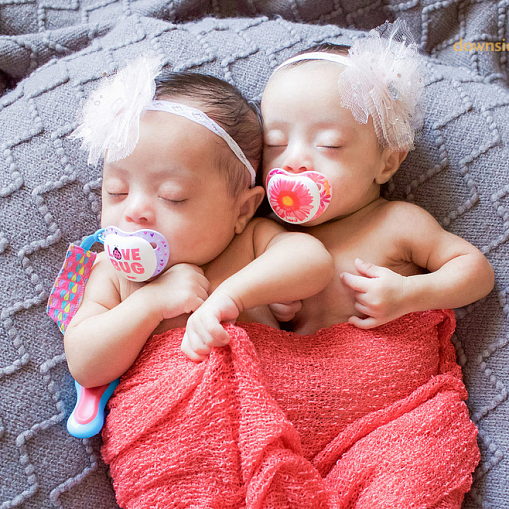 Фотосессия восхитительных близняшек с синдромом Дауна