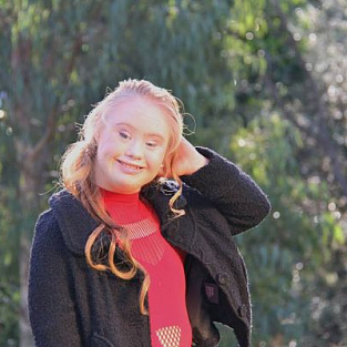 Ради карьеры модели девушка с синдромом Дауна похудела на 18 килограммов