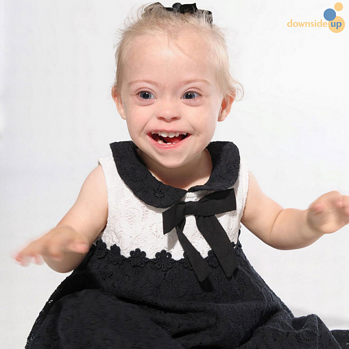 2-летняя девочка с синдромом Дауна стала моделью