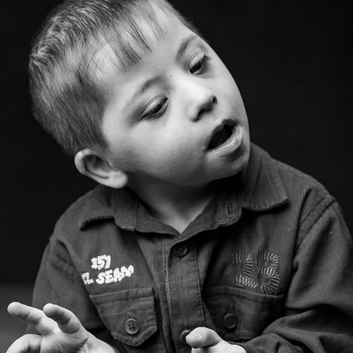 «Синдром любви» - фотовыставка посвященная детям с синдромом Дауна
